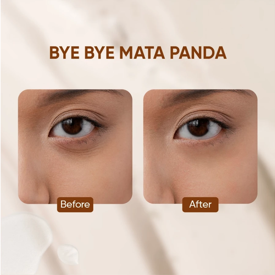 Votre Peau Retinol Eye Cream - Image 5