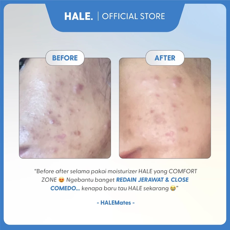 THINK HALE Comfort Zone Soothing Moisturizer - Image 4