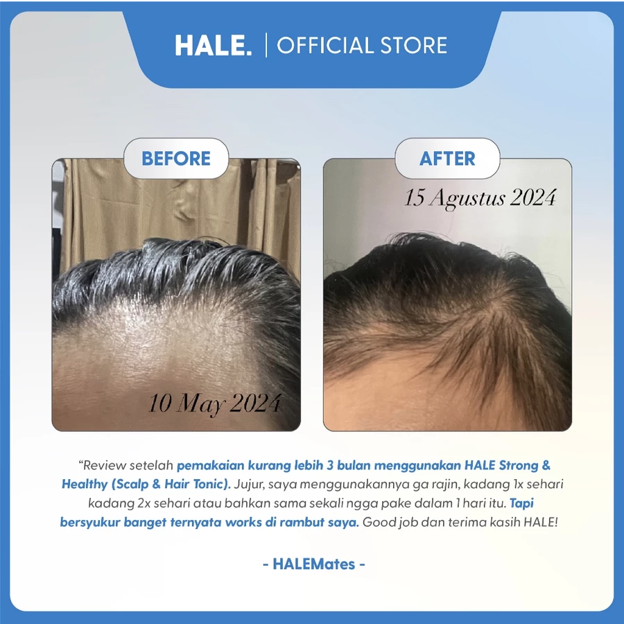 THINK HALE Strong & Healthy Scalp & Hair Tonic 90ml - Image 7